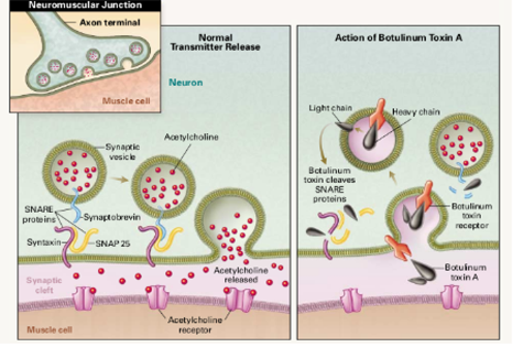 mechanism-action-of-BoNT